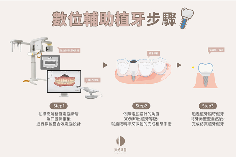 1004 沐光 仿真全瓷美學