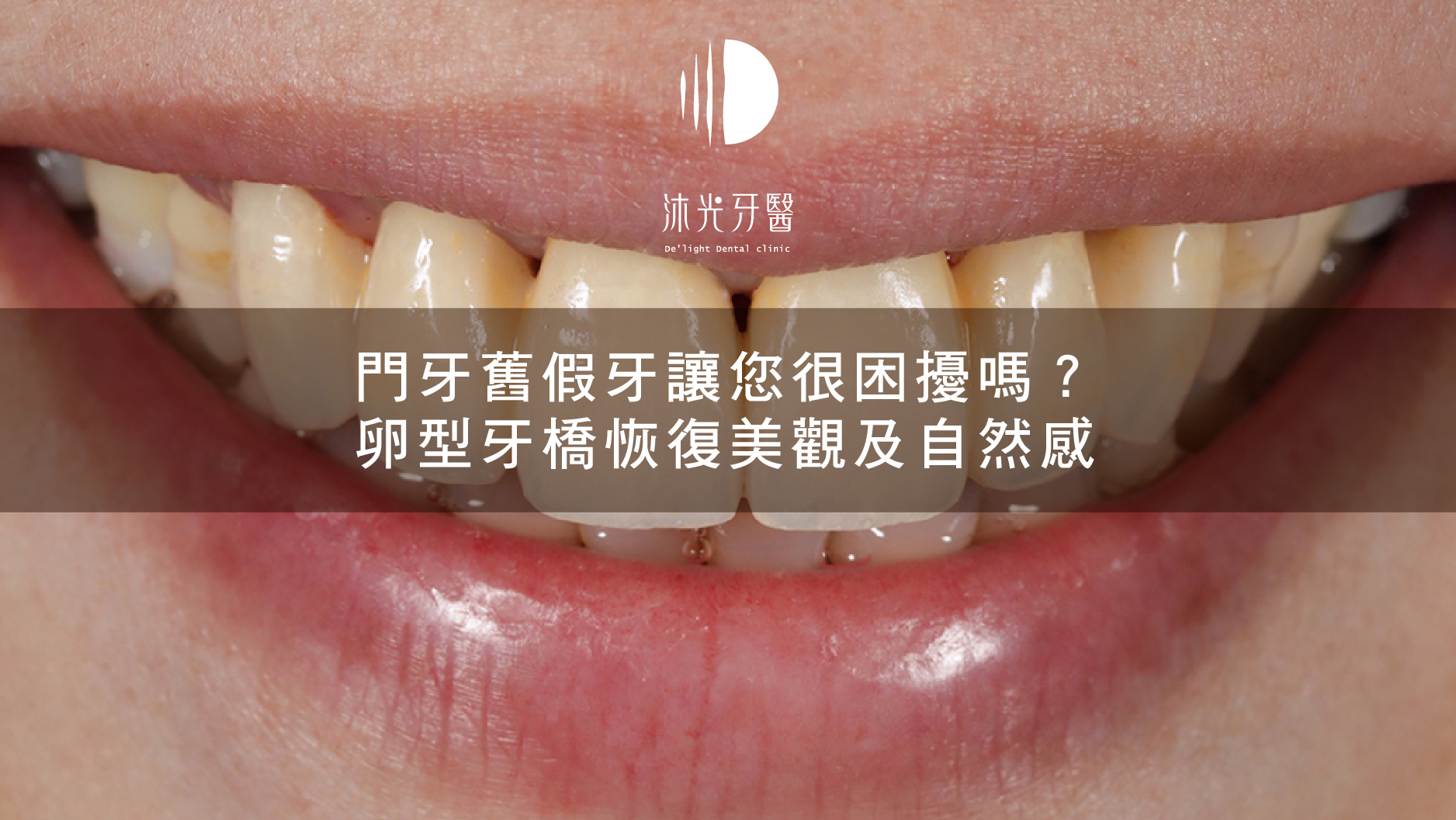 E986abe5b8abe5b088e6ac84 06