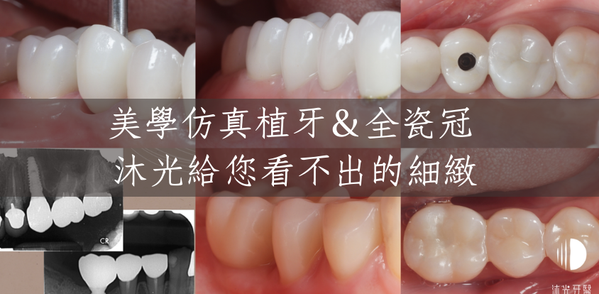 Imagetools0 Edited 2