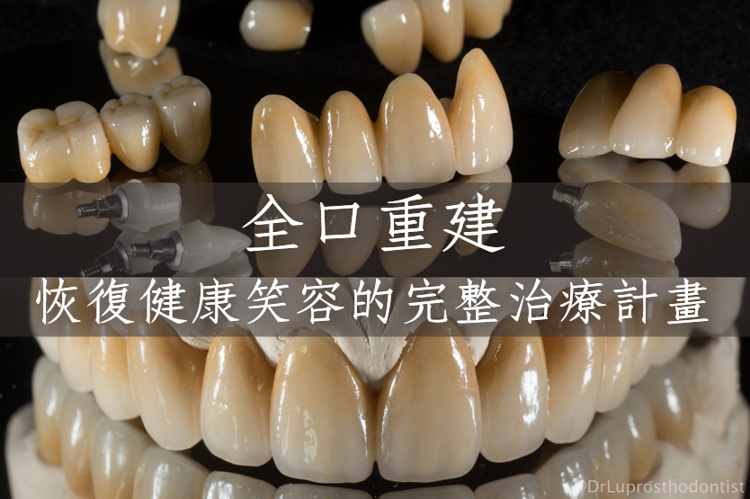 Imagetools0 Edited 4