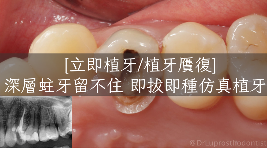 Imagetools0 Edited 6