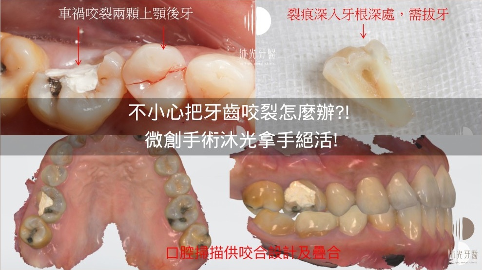 Line Oa Chat 240105 150357