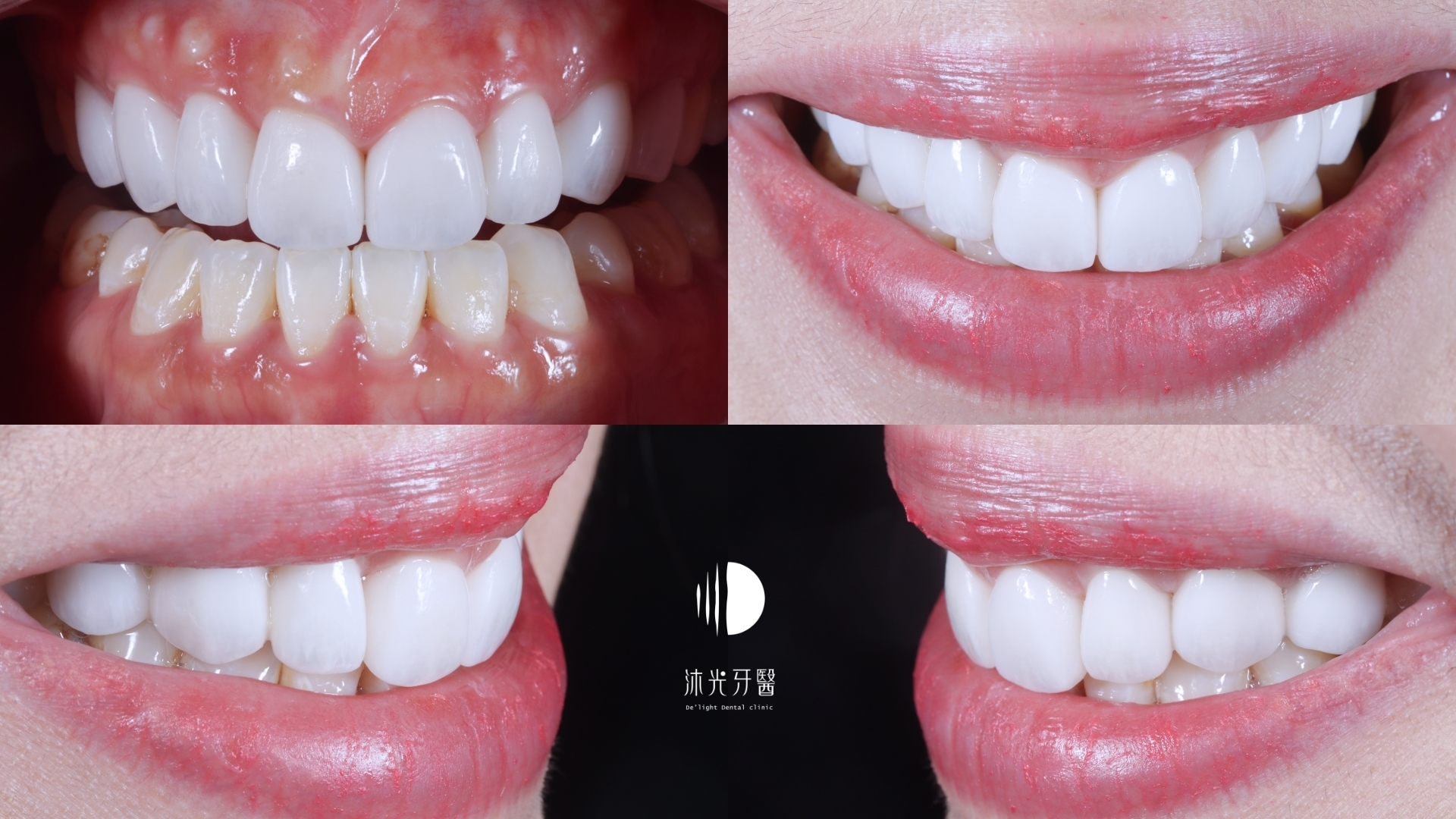 Line album google最新動態 案例 250314 2